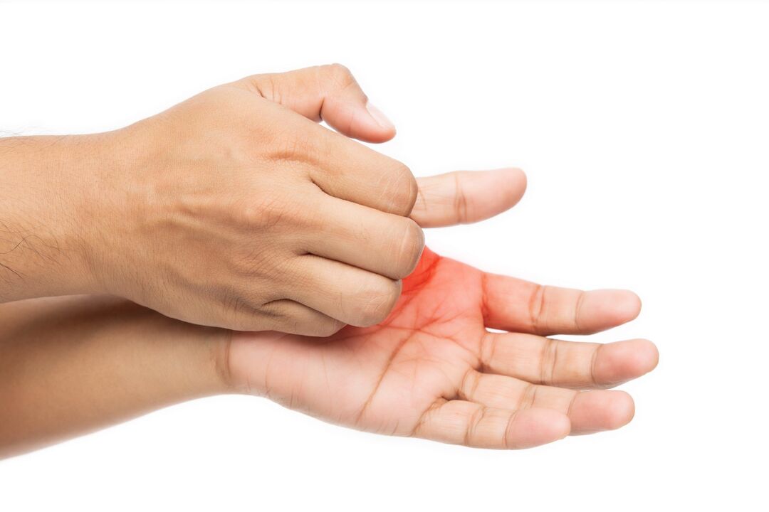 Coceira com fungo e seu tratamento com creme desmyxil