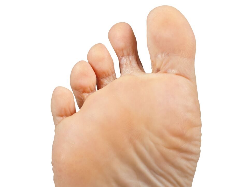 Funger-bom e param e héptico-creme-demixil